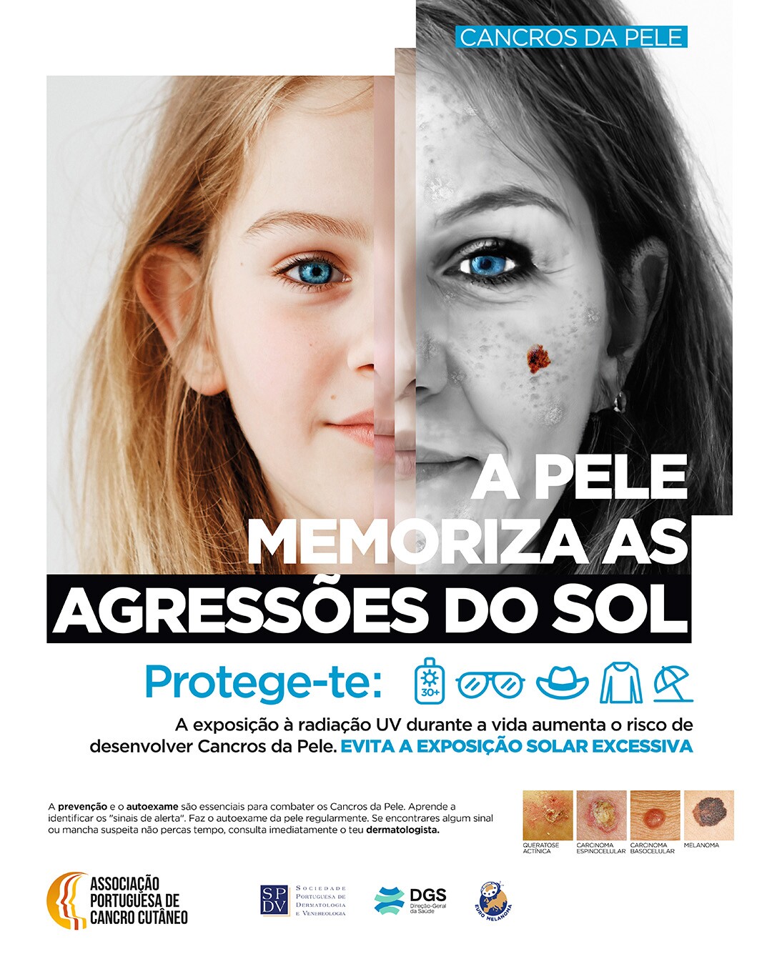 SAÚDE | Evite a exposição solar excessiva ! Proteja a sua pele !